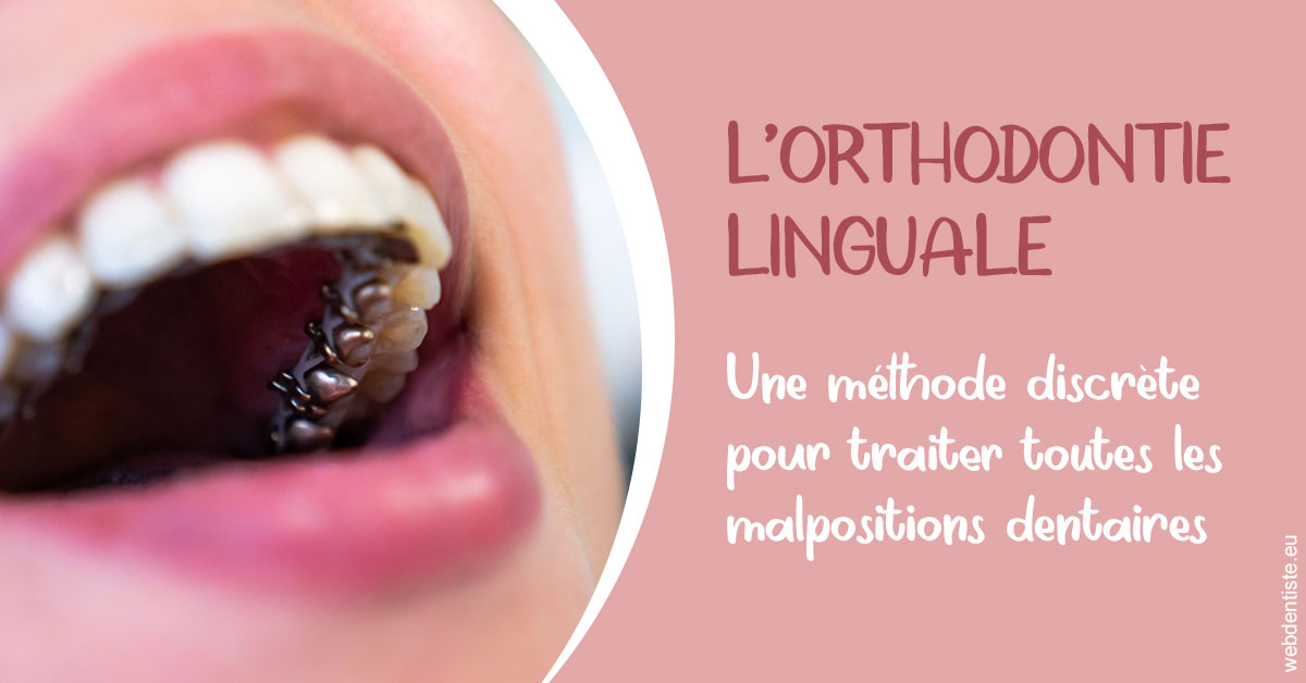 https://dr-cegarra-carolle.chirurgiens-dentistes.fr/L'orthodontie linguale 2