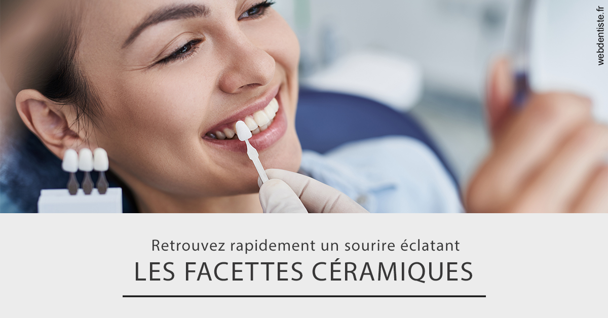 https://dr-cegarra-carolle.chirurgiens-dentistes.fr/Les facettes céramiques 2