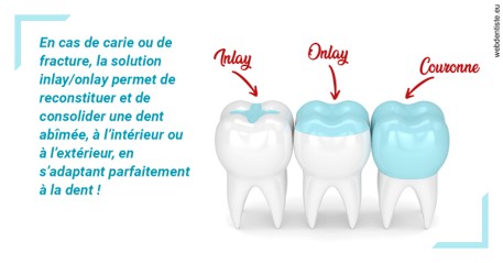 https://dr-cegarra-carolle.chirurgiens-dentistes.fr/L'INLAY ou l'ONLAY