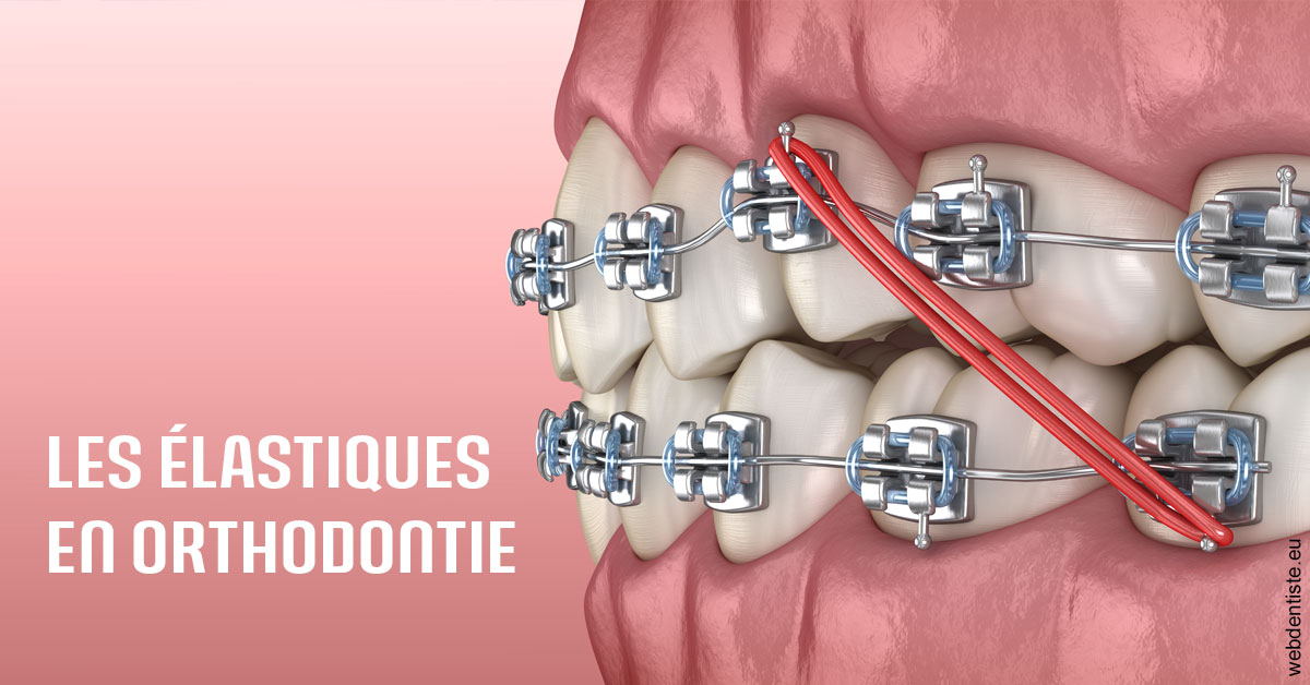 https://dr-cegarra-carolle.chirurgiens-dentistes.fr/Elastiques orthodontie 2