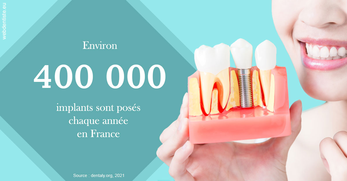 https://dr-cegarra-carolle.chirurgiens-dentistes.fr/Pose d'implants en France 2